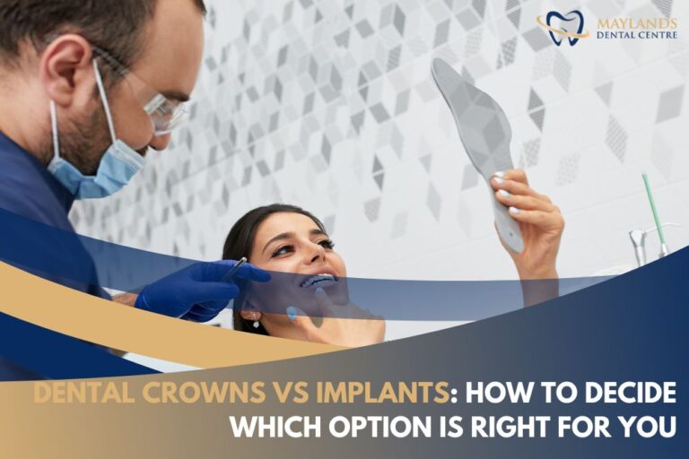 Dental Crowns vs Implants How to Decide Which Option is Right for You Maylands Dental Centre