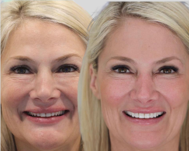 smile gallery 101