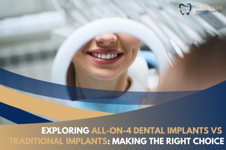 Exploring AllonX Dental Implants vs Traditional Implants Making the