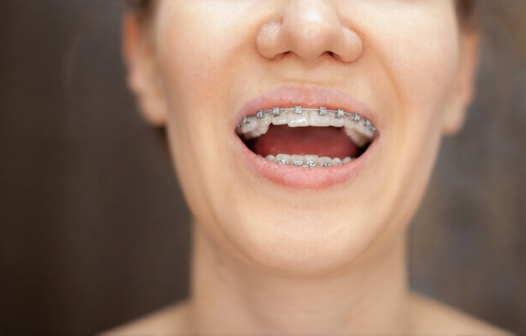 Maylands Dental Centre